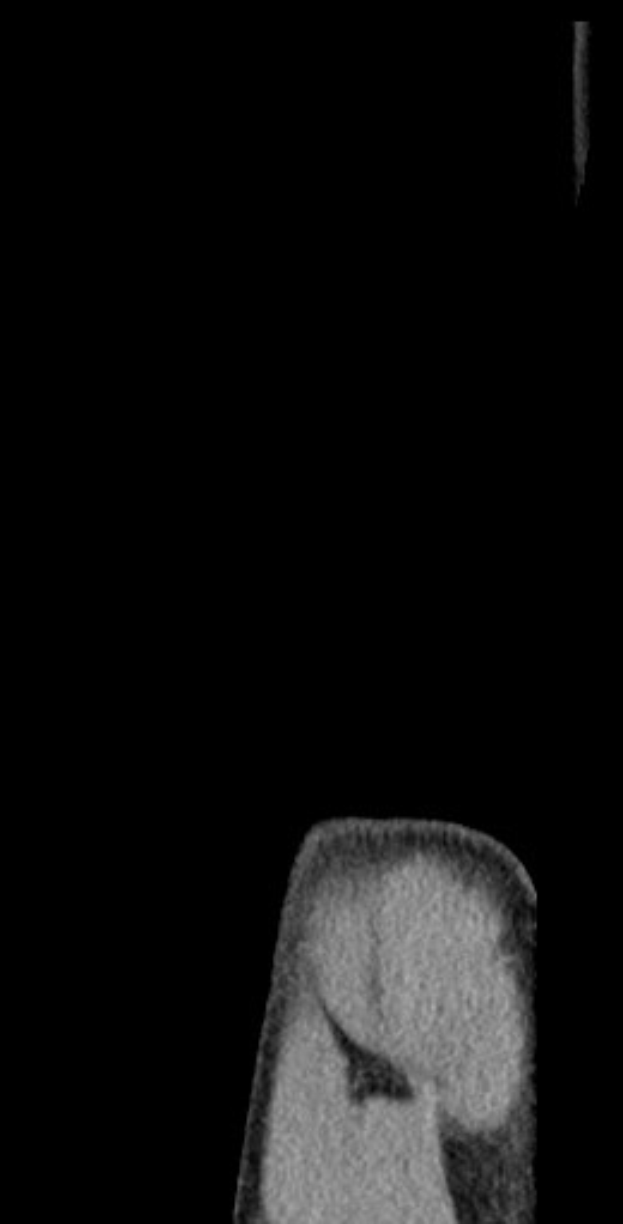 Schwarze und weiße MRT-Aufnahme eines Knies, die detaillierte Innenansichten zeigt.